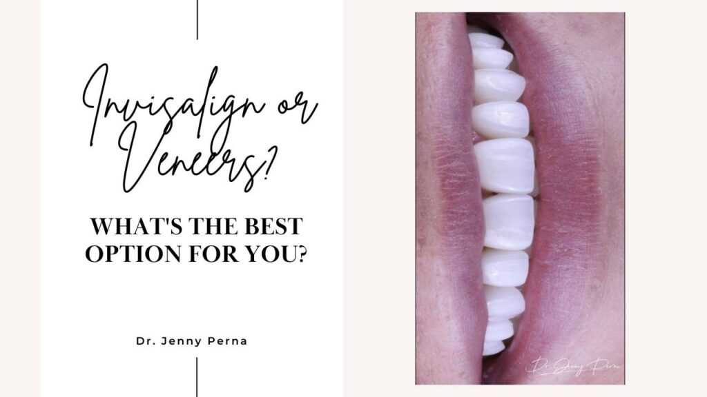 Should you get Invisalign or Veneers?