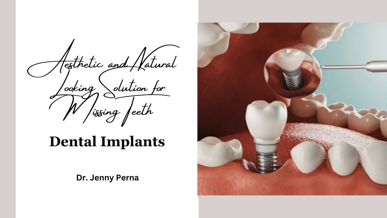 aesthetic benefits of dental implants